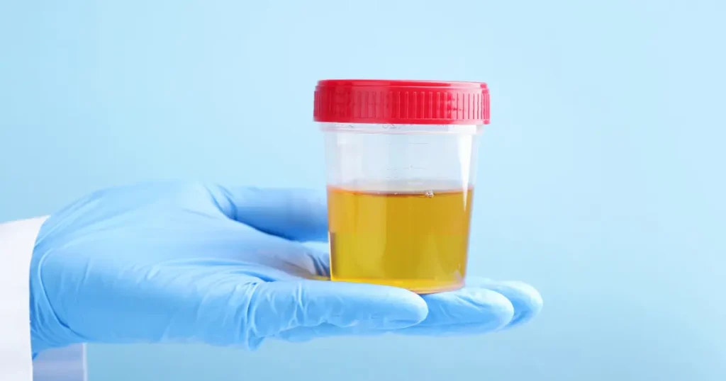 Gloved hand holding a urine sample cup with red lid for drug testing